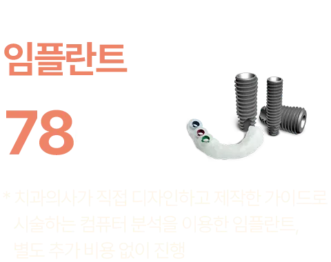 컴퓨터 분석을 이용한 임플란트