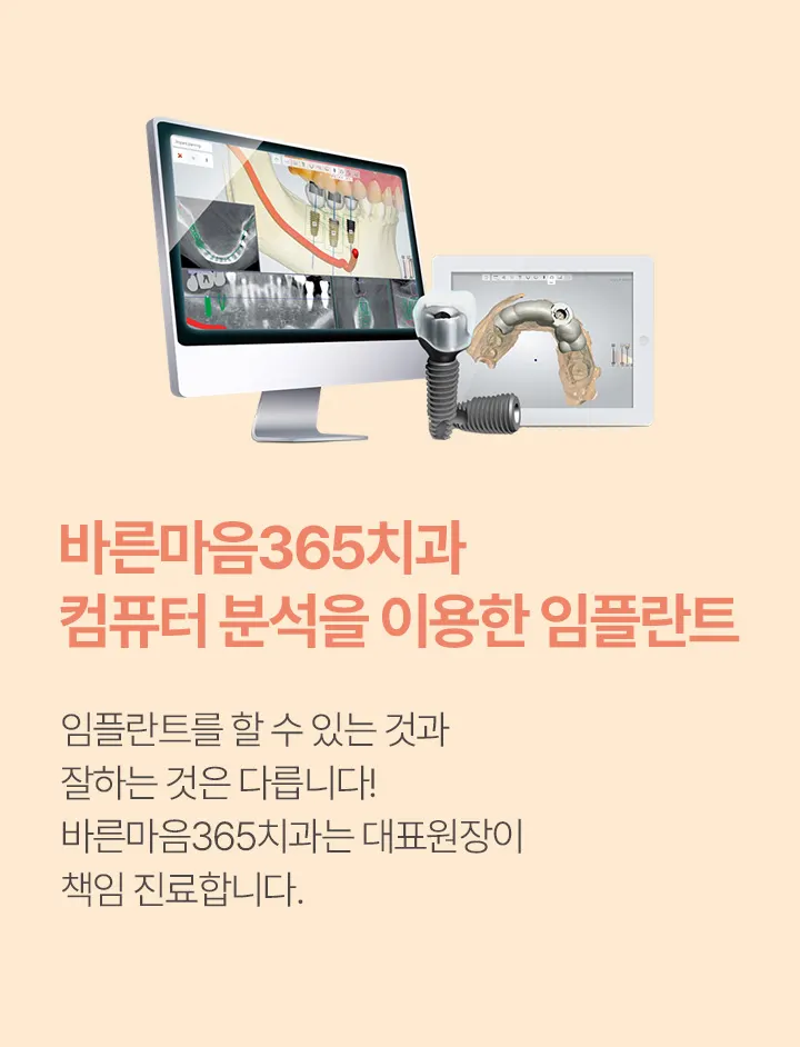 바른마음365치과 컴퓨터 분석을 이용한 임플란트
