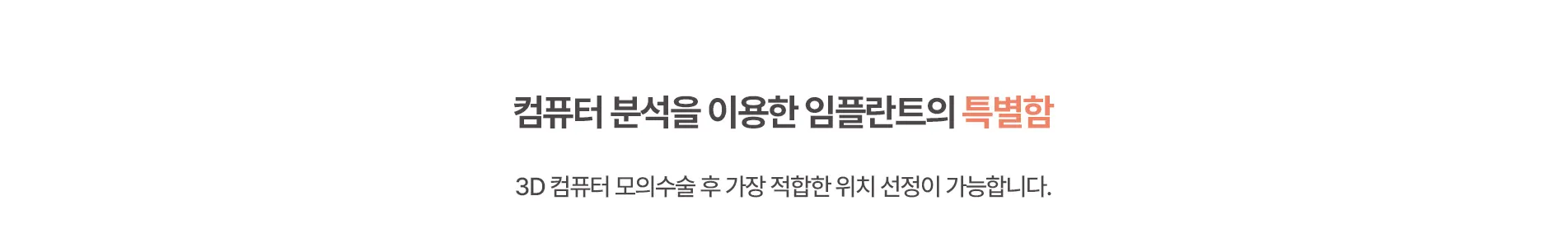 컴퓨터 분석을 이용한 임플란트의 특별함